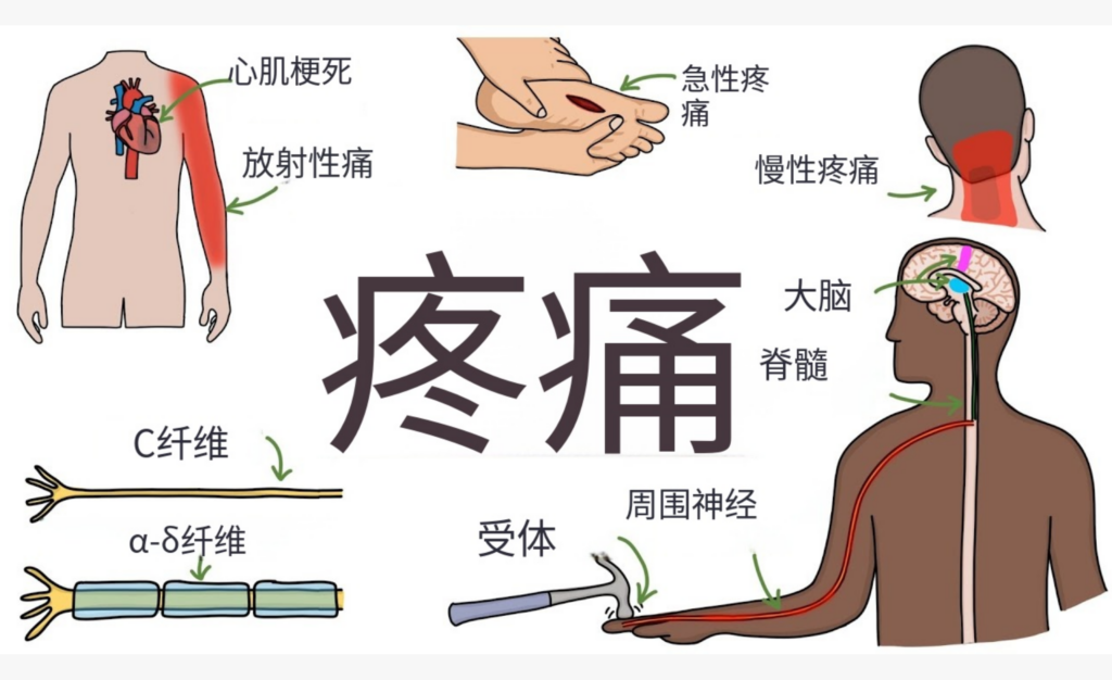 疼痛管理新趋势：从止痛到精准治疗